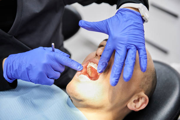 Best Emergency Tooth Extraction in Palestine, IL