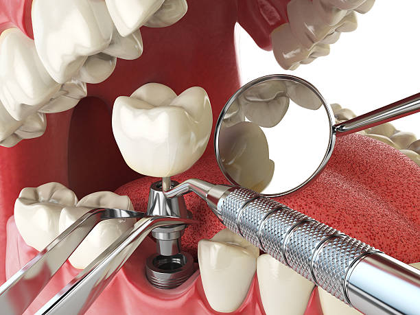 Best Walk-In Emergency Dentist in Palestine, IL